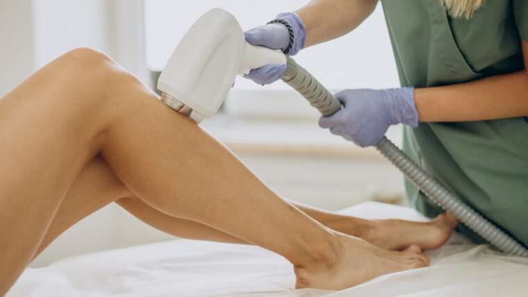 Laser Hair Removal